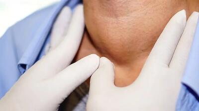 علائم پرکاری تیروئید با توضیحات لادن گیاهی (فیلم)