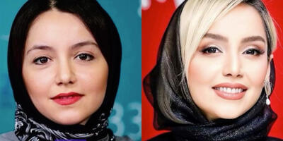 تغییرات چهره نازنین بیاتی از گذشته تا امروز؛ ستاره محبوب دقیقا چه جراحی‌هایی انجام داده؟ - چی بپوشم