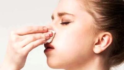 روش‌ های فوری برای متوقف کردن خون‌ دماغ در چند دقیقه