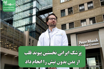 پزشک ایرانی نخستین پیوند قلب از بدن بدون تپش را انجام داد