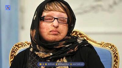 روایت ترسناک آمنه بهرامی از لحظه روبه‌رو شدن با خواستگار اسیدپاش ؛ کور شدن فقط به خاطر جواب منفی