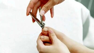 اخبار سلامت و پزشکی از کشف رابطه بین ناخن پا و سرطان ریه / شناسایی سرطان ریه از طریق ناخن ممکن شد