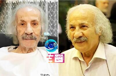 عکس/ چهره شوکه کننده سعید پیردوست پس از بیماری | اقتصاد24