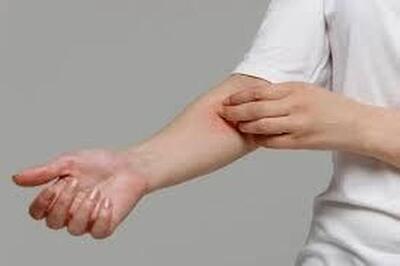  عرق خارشتر چه خواصی برای بدن دارد؟