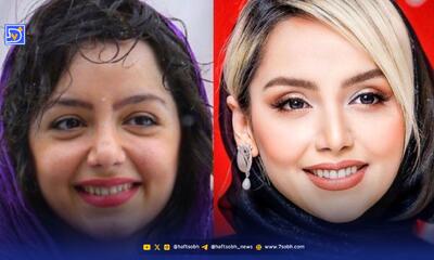  تغییرات چهره نازنین بیاتی از گذشته تا امروز