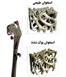  برای افزایش تراکم استخوان چه بخوریم؟/ چه کنیم تا پوکی استخوان نگیریم؟