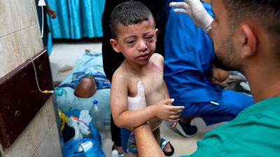  رئیس بخش کودکان بیمارستان ناصر: پنج هزار کودک فلسطینی نیازمند جراحی خارج از غزه هستند