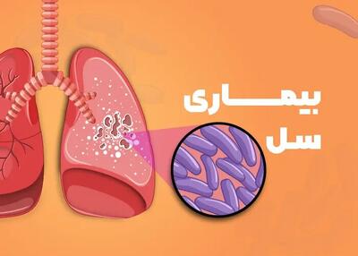  سپهر: ۹۵ بیمار مبتلا به سل در یزد شناسایی شد