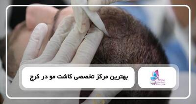  قبل از کاشت مو چه نکاتی را باید رعایت کرد؟ چک لیست آمادگی برای بهترین نتیجه