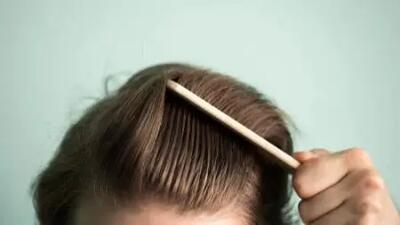 چطور در ۳۰ روز رشد سریع مو داشته باشیم؟ + راهنمای علمی با نکات طلایی