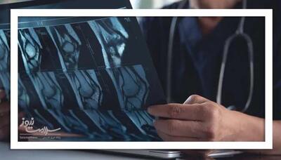 هوش مصنوعی جدید، عکس X-ray زانوی شما در یک سال آینده را نشان می‌دهد