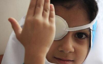  ۳۶ هزار معلول و ۳۹۰۰ نابینا تحت پوشش بهزیستی البرز هستند