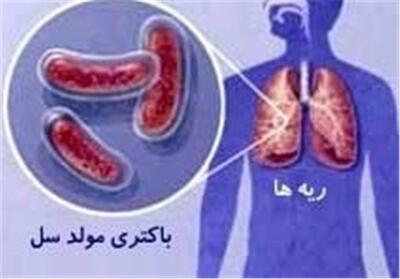 95 مورد بیمار مبتلا به سل در یزد شناسایی شد - تسنیم