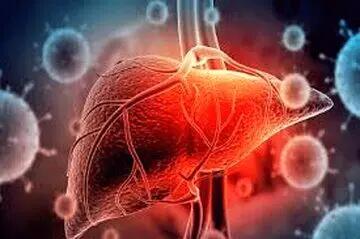  این مکمل‌ ها قاتل کبد چرب است
