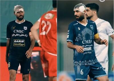  در ستایش کاپیتان: زخم پیشانی نشانه ضعف نیست