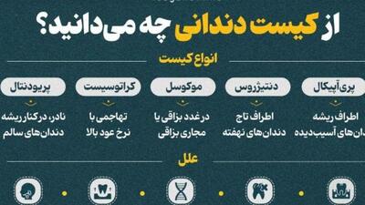  همه چیز درباره کیست دندانی
