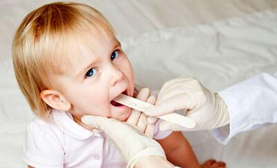  چطور بفهمیم کودک ما لوزه سوم دارد یا نه؟