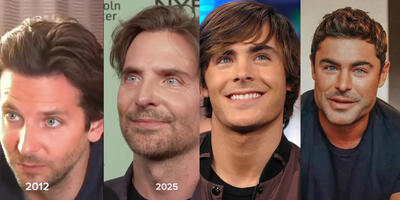  مردان مشهوری که با تزریقات زیبایی طرفدارانشان را خشمگین کردند - چی بپوشم