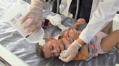  جمعیت امداد پزشکی غزه: ۱۷۰ هزار مجروح در غزه نیاز به جراحی دارند