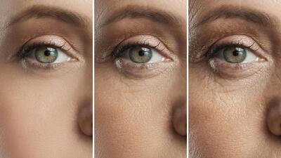  کشف راهکاری انقلابی برای درمان پیرچشمی