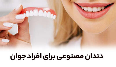  دندان مصنوعی برای افراد جوان | راهنمای کامل و کاربردی