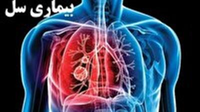  بیماری سل همچنان یک اولویت بهداشتی در کشور است