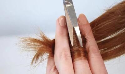  روش های ساده برای پیشگیری از موخوره