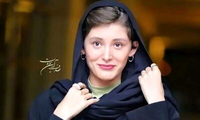  فرشته حسینی با  صورت زخمی  ظاهر شد!