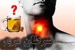  چای داغ؛ مهمترین عامل ایجاد سرطان مری در ایران/ویدیو