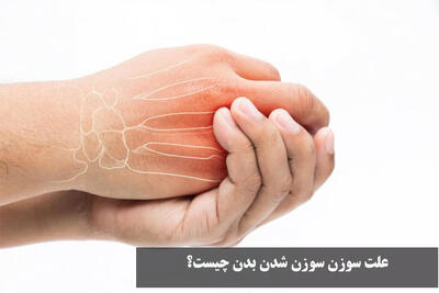  علت سوزن سوزن شدن بدن چیست؟ کمبود کدام ویتامین است؟ + درمان خانگی