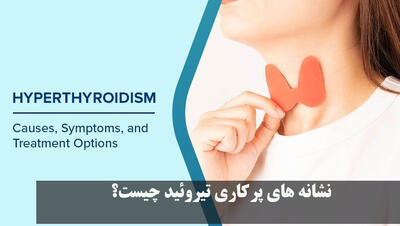  نشانه های پرکاری تیروئید چیست؟ علائم شایع پرکاری تیروئید در زنان و مردان