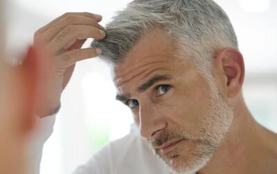  خوراکی های مناسب برای رفع سفیدی مو را بشناسید