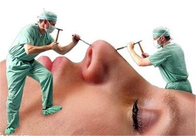  روزی یک‌میلیارد تومان؛ درآمد جراح زیبایی قلابی!/ جراحان قلابی چه کسانی هستند؟