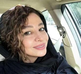  چهره جدید مه‌لقا باقری: تغییرات جنجالی پس از عمل زیبایی!