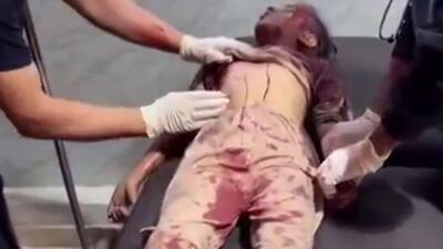  شهادت و زخمی شدن کودکان در حمله رژیم صهیونیستی به مدرسه‌ای در مرکز نوار غزه