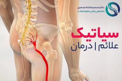 سیاتیک چیست و چه علائمی دارد؟ بهترین درمان از نظر دکتر شاه محمدی متخصص دیسک کمر
