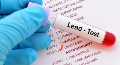  چه میزان سرب برای بدن بیش از حد محسوب می‌شود؟