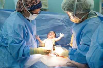  واقعیت زایمان در بیمارستان‌های دولتی و خصوصی - اکونیوز