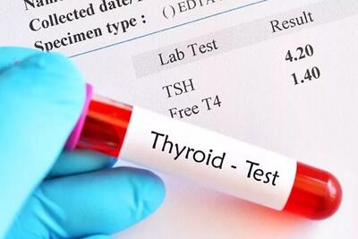  زنان پیش از بارداری آزمایش تیروئید بدهند