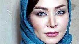 چهره واقعی فقیهه سلطانی قبل از عمل زیبایی! +عکس
