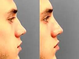  ارزیابی شرایط روحی فرد از طریق مدل بینی‌ ممکن شد