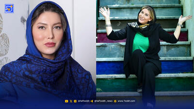  چهره قبل از عمل فریبا نادری با بینی پهن!