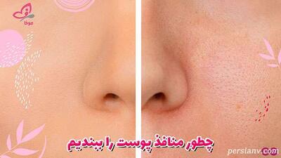  چطور منافذ پوست را ببندیم؟ راهنمای کامل برای پوستی صاف و یکدست