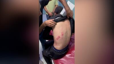  آثار شکنجه جوان فلسطینی در بازداشتگاه ارتش صهیونیستی + فیلم
