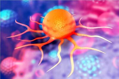  سرطان روده سپر انداخت