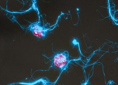  فیلم‌برداری از مهمانی میکروب‌ها در اقیانوس با کاوشگر مولکولی