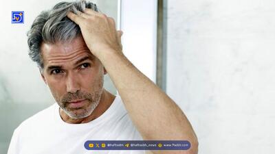  بهترین روش‌های مقابله با سفیدی زودرس موها