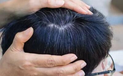  این یافته جدید درباره سفید شدن مو را از دست ندهید