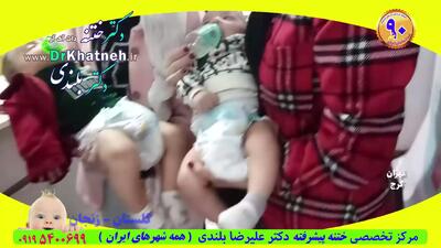  ختنه پیشرفته ختنه مدرن استاد دکتر بلندی