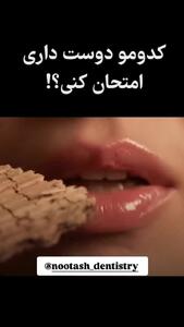  کدومو دوس داری امتحان کنی؟ _ کلینیک دندانپزشکی نوتاش